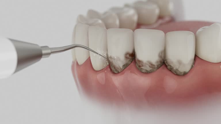 Reliable Dental Implants contractor in Sells, AZ by Smile Center Dentistry
